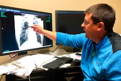 In this Jan. 24, 2019 file photo Dr. Brandon Crum points to the X-ray of a black lung patient at his office in Pikeville, Ky. A report released Tuesday, Dec. 10 by the Washington-based group Taxpayers for Common Sense says a cut to the tax that coal companies pay to fund the Black Lung Disability Trust Fund, a trust for sick miners, will cost taxpayers billions of dollars.