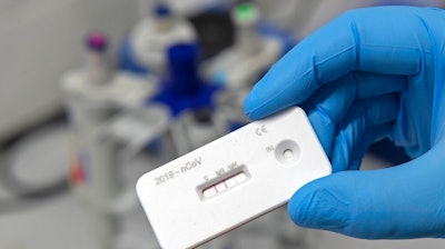 A scientist presents an antibody test for coronavirus in a laboratory of the Leibniz Institute of Photonic Technology (Leibniz IPHT) at the InfectoGnostics research campus in Jena, Germany, Friday, April 3, 2020.