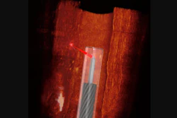 Ultra-thin, 3D-printed endoscope imaging an artery.