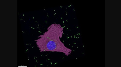 Confocal fluorescence image of gold nanotures (green) in mesothelioma cells