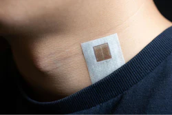 Ultrasound patch worn on the neck.