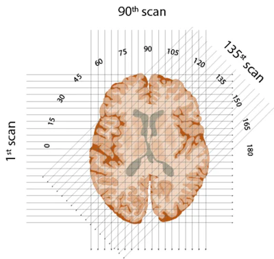 X-rays beam through each ‘slice’ of brain, oriented at each degree from 1 to 180 in a semicircle.