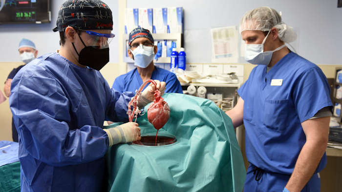 Members of the surgical team show the pig heart for transplant into patient David Bennett, Baltimore, Jan. 7, 2022.