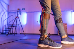 Robotic ankle assistance device invented by NAU mechanical engineer Zach Lerner.