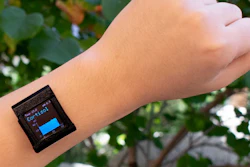Cortisol is well-suited for measurement through wearable devices, according to study co-author Sam Emaminejad, because its concentration levels in sweat are similar to its circulating levels.