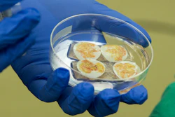 Thymus tissue for transplant to a pediatric heart patient, Duke University Hospital, Durham, N.C., Aug. 16, 2021.