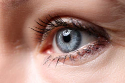 Eye