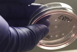 Brain organoids in a petri dish, representative of research from Sierra Space and UC San Diego partnership to develop the first stem cell research institute in space.