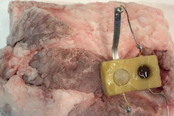 A proof-of-concept sensor designed from edible materials produces a visible color change (seen in the right circle) as a piece of frozen pork thaws.