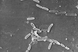 This scanning electron microscope image made available by the Centers for Disease Control and Prevention shows rod-shaped Pseudomonas aeruginosa bacteria.