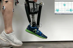 Demonstration of the robotic prosthetic ankle. Electromyographic sensors (on calf at left) capture electrical activity generated by muscles when they are flexed. This signal tells the prosthesis which artificial muscle to flex and how much to flex. For individuals with amputation, these sensors are placed in the prosthetic socket. The graph (right) shows the electromyographic signal, which is used to control the prosthesis.