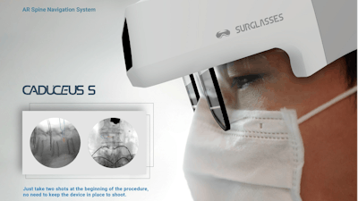 Surglasses Caduceus S Augmented Reality Spinal Surgery Navigation System Requires